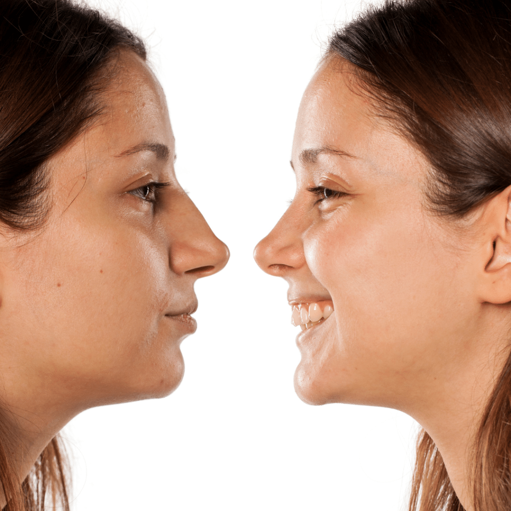 Navigating Bipolar disorder